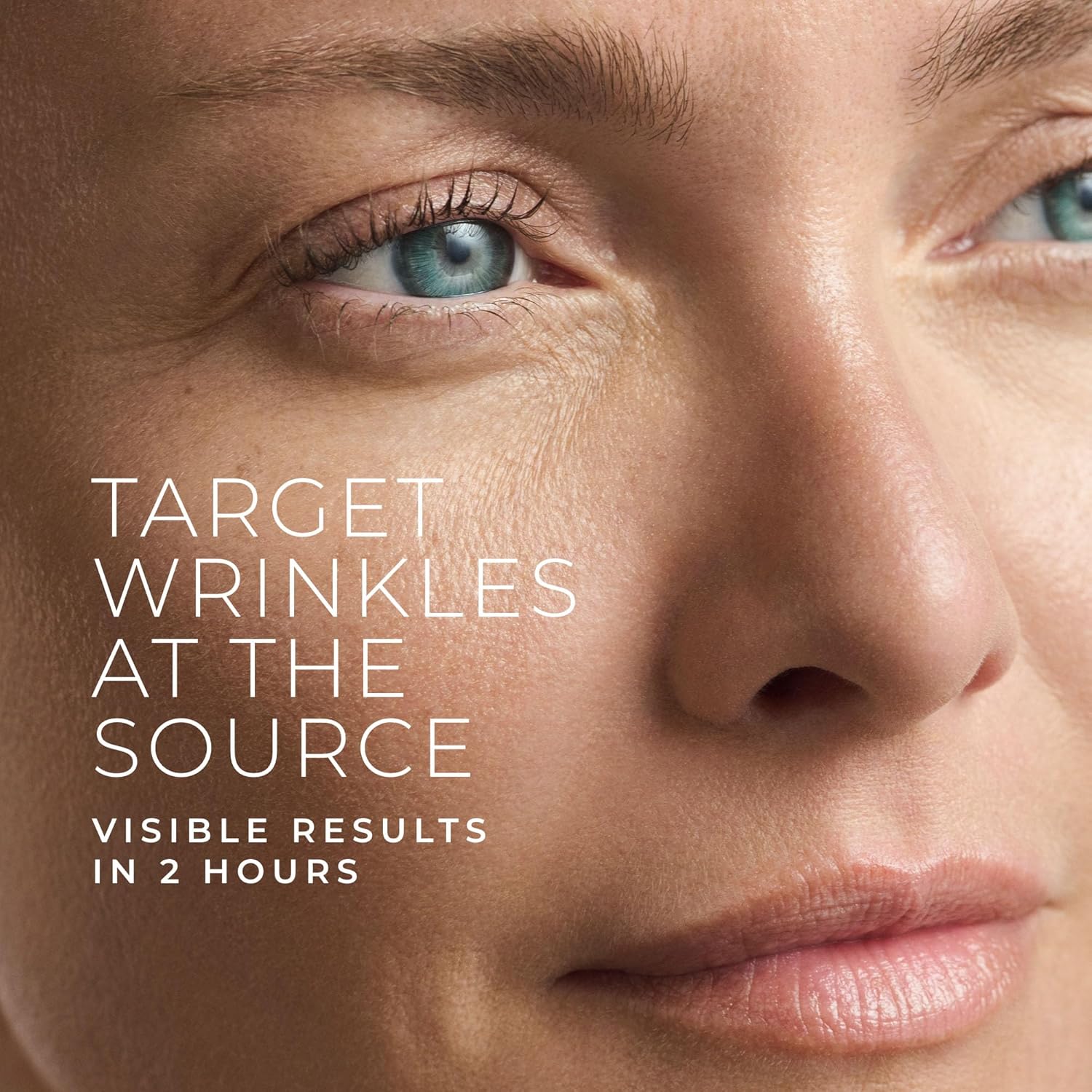 Hyaluronic Acid Retinol Micron - Microneedle Patch Eye review and price